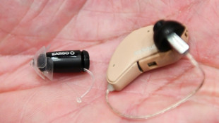 Fraudes en France: les margoulins de l'audioproth&egrave;se dans le collimateur de la S&eacute;cu