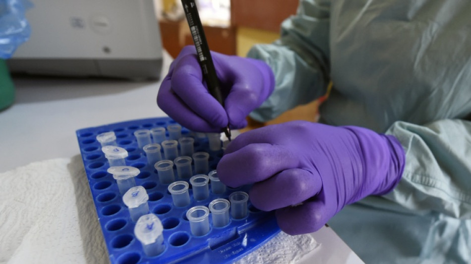  Nigeria Ebola case matches DR Congo strain 