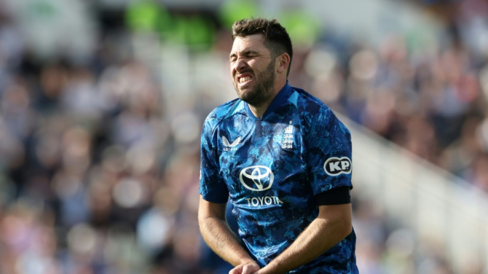 England's Overton ruled out of West Indies series