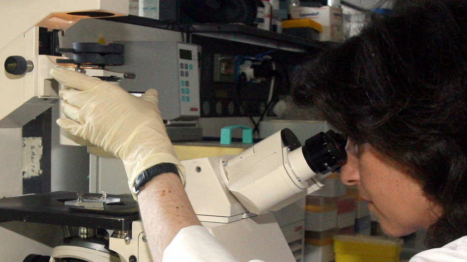  Le prime spie del Parkinson sono nelle sinapsi, studio scopre nuova funzione proteina 